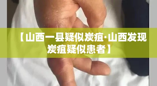 【山西一县疑似炭疽·山西发现炭疽疑似患者】